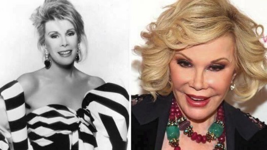 Joan Rivers