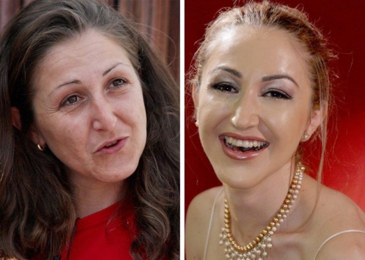 Uczestniczka Extreme makeover