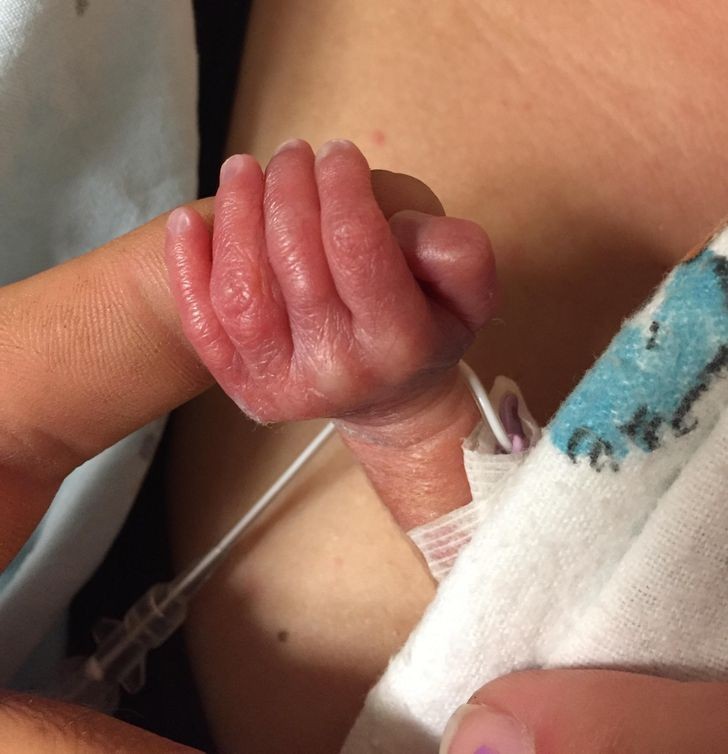 "Moja przedwcześnie urodzona córka po raz pierwszy trzymająca mój palec."