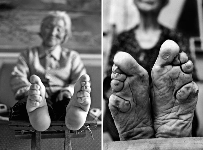 4. Chińska tradycja z X wieku - krępowanie stóp