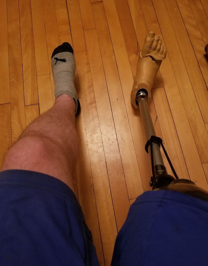 "Pies mojego znajomego potraktował moją stopę protezy jako zabawkę do gryzienia."