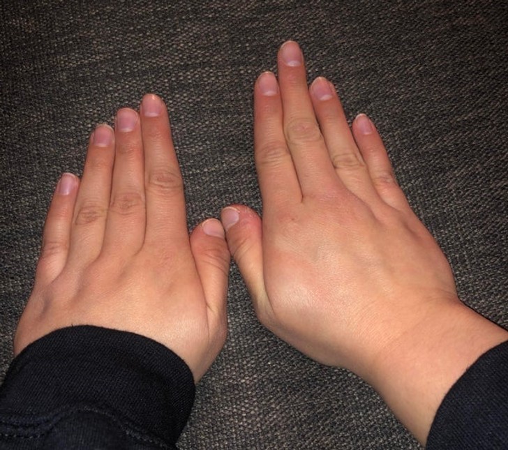 2. „Moja dziewczyna posiada różną strukturę palców u obu dłoni.”