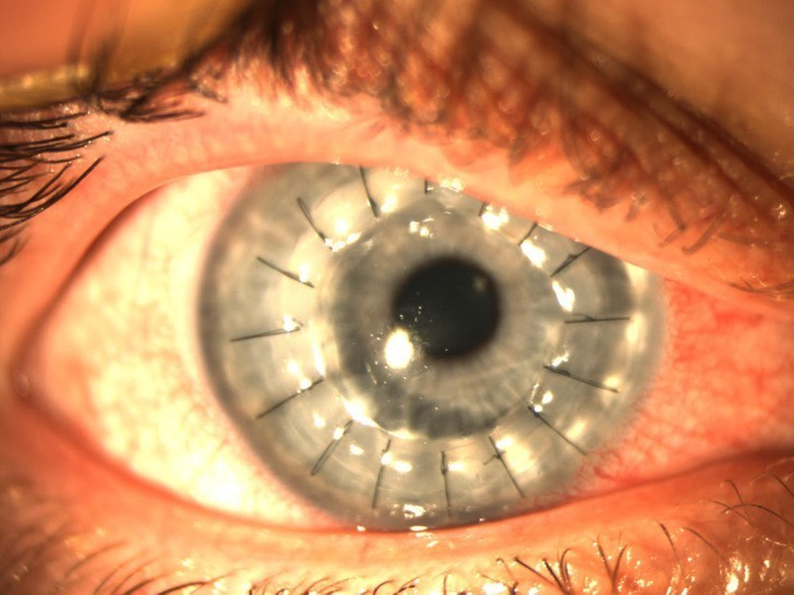 1.