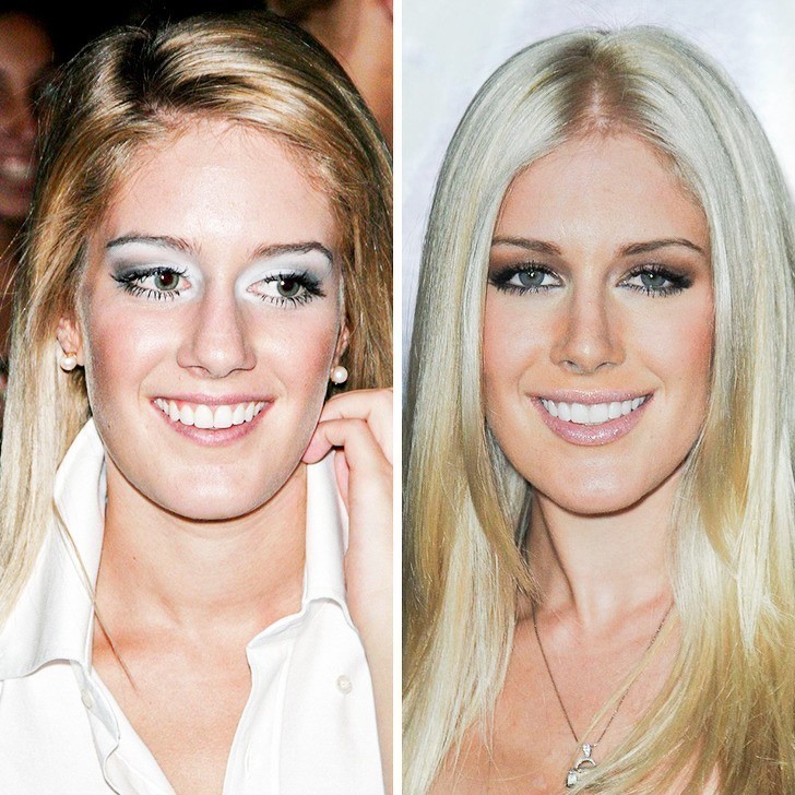 Heidi Montag