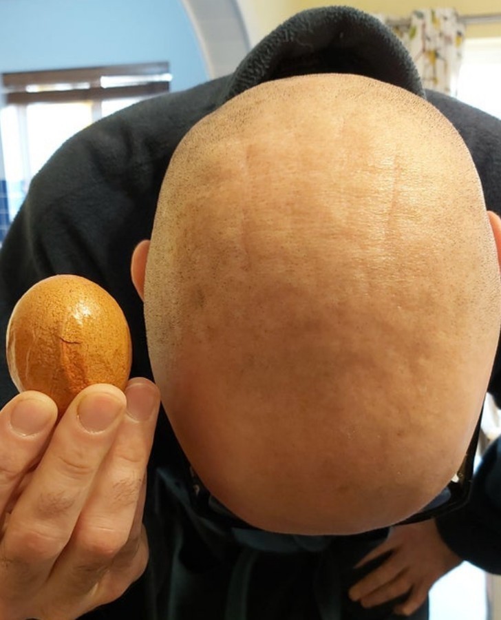 "To dziwne pomarszczone jajko pasuje do dziwnej pomarszczonej głowy mojego męża."