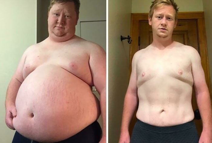 "Zrzuciłem 90 kg w ciągu roku. Ścisła dieta i codzienne spacery po 5 km."