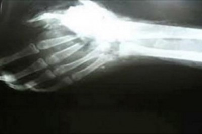 18 zaskakujących  faktów o osobach leworęcznych o których mogłaś nie mieć pojęcia! Kiedyś ich karano!