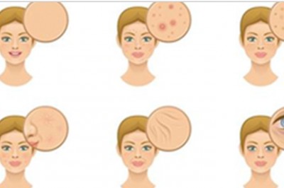 5 objawów braków witamin które możesz wyczytać ze swojej twarzy! Dowiedz się co wtedy jeść! 