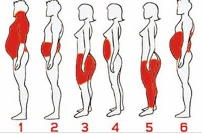 6 typów otyłości - poznaj różnice oraz dowiedz się jak z nimi walczyć! Precyzyjne działania dają skutki!