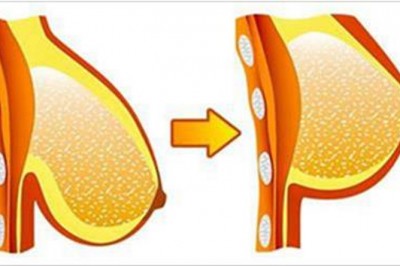 7 ćwiczeń dzięki którym w naturalny sposób skutecznie podniesiesz Twoje piersi! Zrobisz to bez operacji!