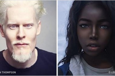 8 osób, których unikalny kolor skóry podbił świat.Ich uroda zachwyciła tysiące ludzi!