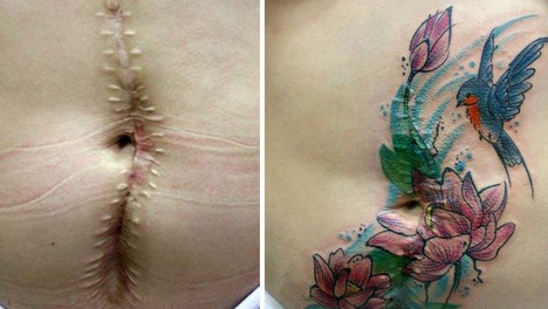 Były ofiarami przemocy domowej. Te tatuaże pomogły im odzyskać pewność siebie! 
