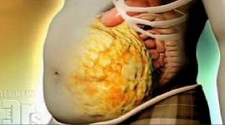 Chcesz przyspieszyć metabolizm i pozbyć się toksyn z organizmu? Ta prosta receptura daje efekt w 72h!