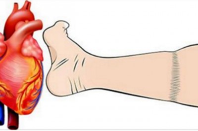 Cztery częste objawy ataku serca których NIGDY nie należy ignorować! Może uratować Ci życie!