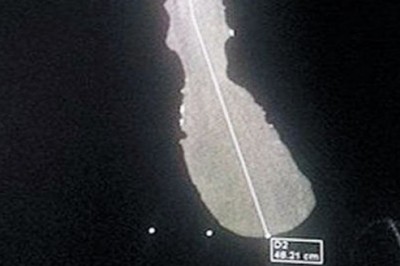 Facet z największym na świecie przyrodzeniem ma poważny problem. Nie uwierzysz w te gabaryty! 