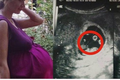 Gdy trafiała na oddział lekarze bali się jej dotknąć! Jej brzuch skrywał prawdziwy fenomen! 