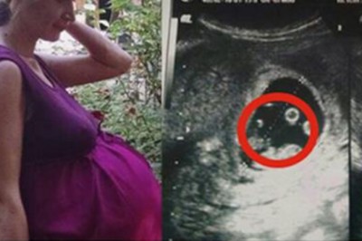 Gdy trafiała na oddział lekarze bali się jej dotknąć! Jej brzuch skrywał prawdziwy fenomen!