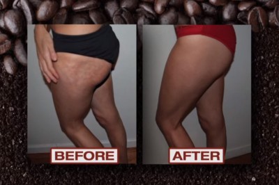 Jak przy pomocy kawy pozbyć się cellulitu! Żałuję, że nie wiedziałam o tym wcześniej! 