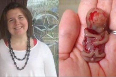 Jej dziecko przychodzi na świat w 11 tygodniu ciąży! Jej słowa po wszystkim dadzą Ci do myślenia! 