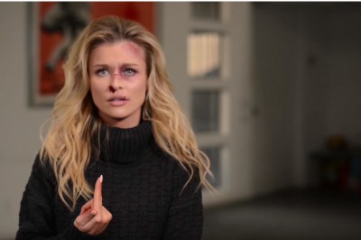 Joanna Krupa cała w siniakach! Mocna kampania przeciwko przemocy wobec zwierząt! 