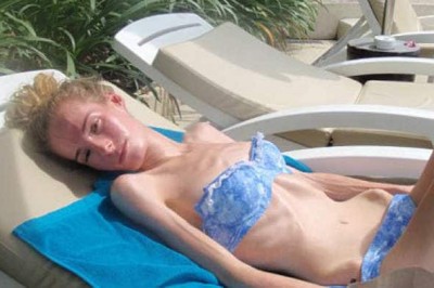 Lekarze dawali jej 48 godzin życia! Tata  każdego ranka zakrada się do jej pokoju sprawdzić jedną rzecz!