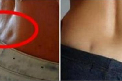 Masz na plecach takie dołeczki? Dowiedz się co to oznacza dla Twojego ciała i życia seksualnego!