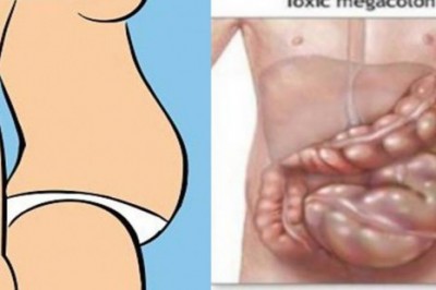 Nie jesteś gruba! Zobacz jak pozbyć się wzdęć które mogą rujnować Twoją sylwetkę! 