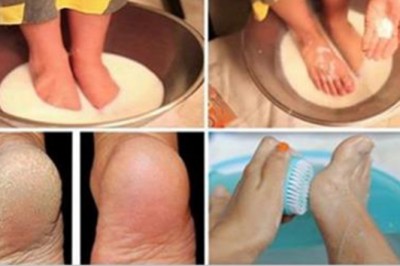 Nie trać więcej pieniędzy na pedikiur! 2 składniki które masz w kuchni sprawią, że stopy wyglądają cudnie!