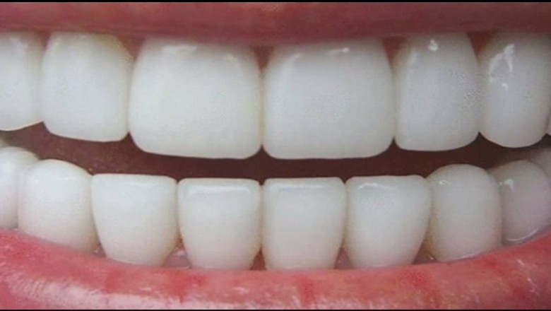 Niesamowity 3 minutowy sposób jak uzyskać naturalnie białe zęby w domu! 