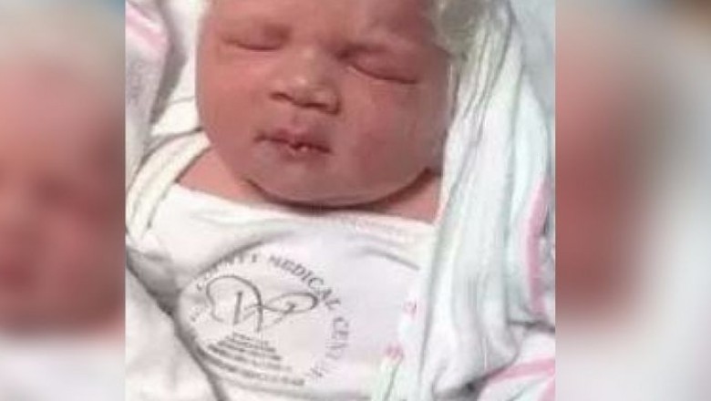 Nikt w szpitalu nie widział jeszcze dziecka z takimi włosami! Chłopiec zachwycił cały personel!