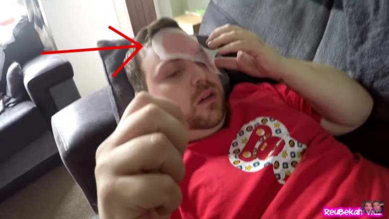 Postanowiła rozruszać swojego faceta! Zobacz reakcję gdy przykleiła mu plaster do depilacji do twarzy!