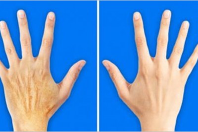 Poznaj 5 sekretów które sprawią, że Twoje dłonie będą wyglądały o 10 lat młodziej! Super efekt!