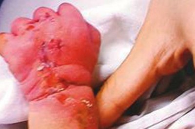 Położna zagląda do matki z dzieckiem! Widząc co matka robi niemowlakowi zaczyna krzyczeć! 