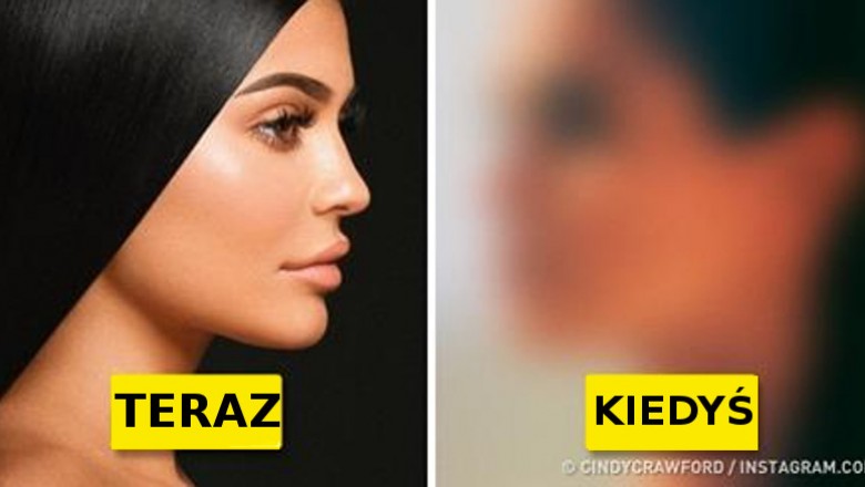 Prawdziwe piękności bez Photoshopa! Zobacz jak wyglądały Top modelki 20 lat temu!