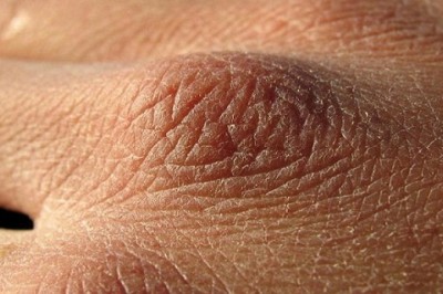 Przeczytaj to koniecznie! 8 oznak, że pijesz za mało wody i Twoje ciało wysycha!