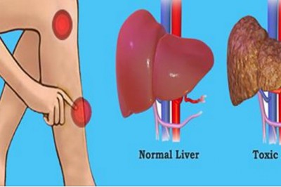 Te sygnały wysyła Twoja wątroba jeśli masz za wysoki poziom toksyn! Przez to zaczynasz tyć! 