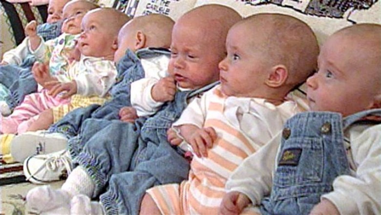 To były pierwsze siedmioraczki na świecie! Zobacz jak wyglądają w tym roku gdy kończą 20 lat!