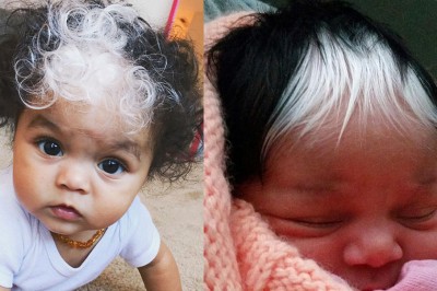 Urodziła się z niesamowitą białą grzywką! Jednak gdy zobaczyłam jej mamę wszystko stało się jasne!