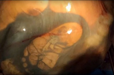 W 41 tygodniu ciąży przychodzi na USG! To co lekarz odkrywa podczas badań odbiera wszystkim mowę! 