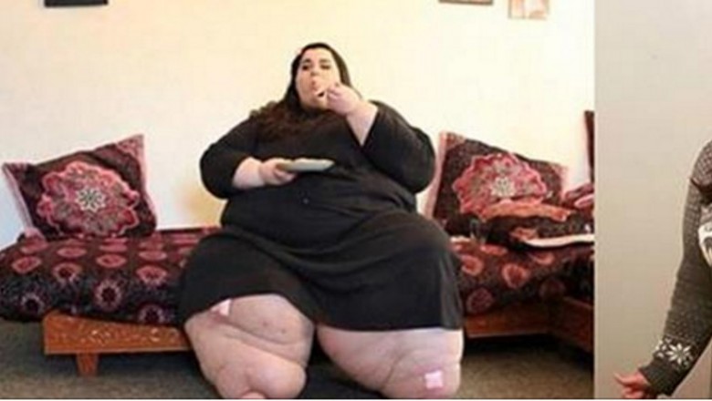 Ważąc 300 kg przechodzi operacje zmniejszenia żołądka! Gdy lekarz zobaczył ją po roku nie poznał jej!