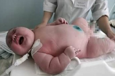 Ważąca 270 kg kobieta zaszokowała lekarzy! Rodzi największe dziecko świata ważące aż 18 kg! 