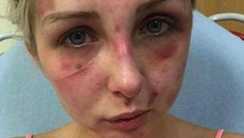 Zamknął dziewczynę w pokoju i przez 4 godziny ją katował! Spotkała go zbyt łagodna kara?