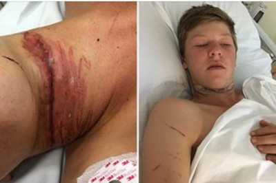 Zwykłe słuchawki prawie podcięły mu gardło! Każdy lubi mieć je w uszach ale mogą być niebezpieczne!