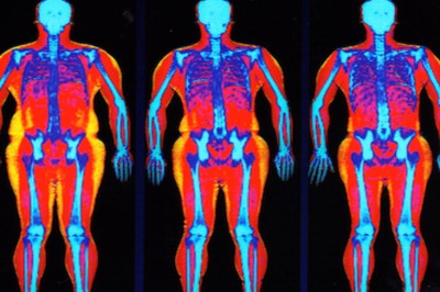 Ćwiczyła intensywnie ale waga nie chciała spadać! Wtedy lekarz pokazał jej te zdjęcie! 