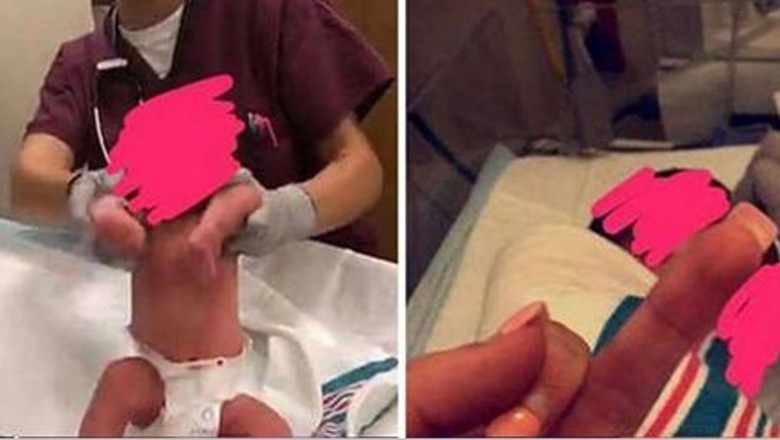 Pielęgniarki wykorzystały maluchy do zdjęć w skandaliczny sposób! Pochwaliły się w sieci! 