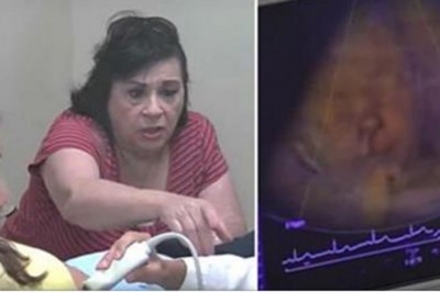 Babcia widzi twarz dziecka podczas badania USG! W pewnym momencie pyta córki co się dzieje!