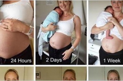 Odważna mama pokazuje zdjęcia brzucha dzień po urodzeniu! 14 tygodni później zupełnie się zmienia!