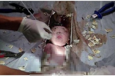 Ukrywała że jest w ciąży i noworodka próbowała spuścić w toalecie! Zobacz niezwykłą akcje ratunkową!