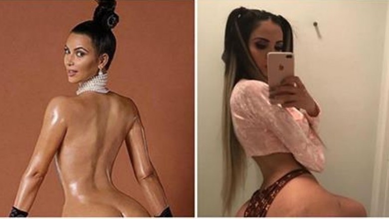 Ta kobieta wstrzyknęła 2 litry tłuszczu w pośladki, żeby mieć pupę jak Kim Kardashian! Rachunek 240 tys!