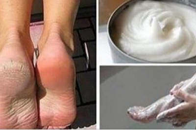 Tania i sprawdzona kuracja stóp. Nigdy więcej popękanych pięt!